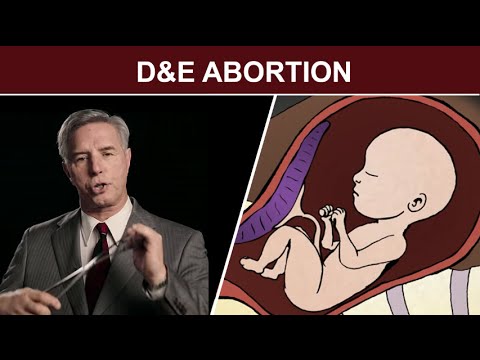 Cine vede aceste imagini NU mai face AVORT! Animaţie medicală care ne arată ce se întâmplă cu fătul şi mama în timpul avortului
