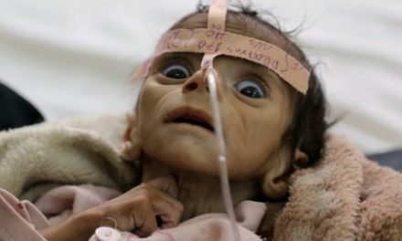 Fostul consilier al președintelui Reagan, Pat Buchanan, denunță blocada impusă Yemen-ului de către Arabia Saudită cu ajutor american: Suntem gata să stăm și acceptăm că mii, zeci de mii de civili, vor muri de foame și de boli?