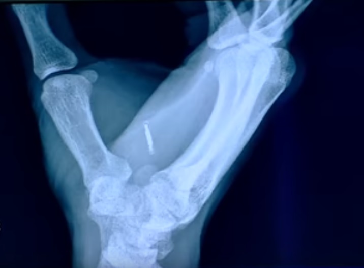 Despre testul din 2019, când în România se vor putea face plăți cu cipul implantat în mână în anumite rețele de hypermarket