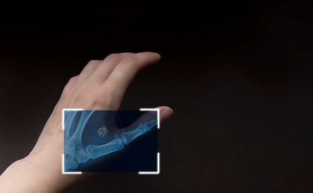 Rafila vrea „certificatul Stop Covid” (ceea ce s-a numit până ieri ”certificat verde”) trecut luna asta prin Parlament și Formularul de Localizare a Pasagerului implementat până pe 20 decembrie. Fost colonel STS: Nu va trece mult până când ambele vor fi și ele sub formă de plastice microcipate