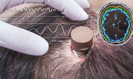 Tăvălugul transumanismului merge implacabil mai departe: sub pretextul rezolvării unor boli sau probleme neurologice, controlul de la distanță al creierului uman prin implantarea cipului – tot mai eficient…