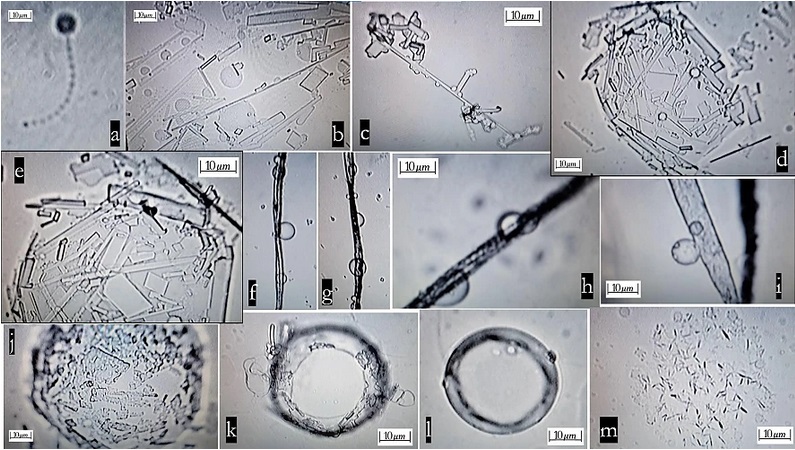 ”Teoria Conspirației” cu nano-elemente artificiale care se auto-ansamblează în serurile Pfizer și Moderna, demonstrată într-un STUDIU International Journal of Vaccine Theory, Practice, and Research – Este citată o analiză a d-nei dr. Geanina Hagimă